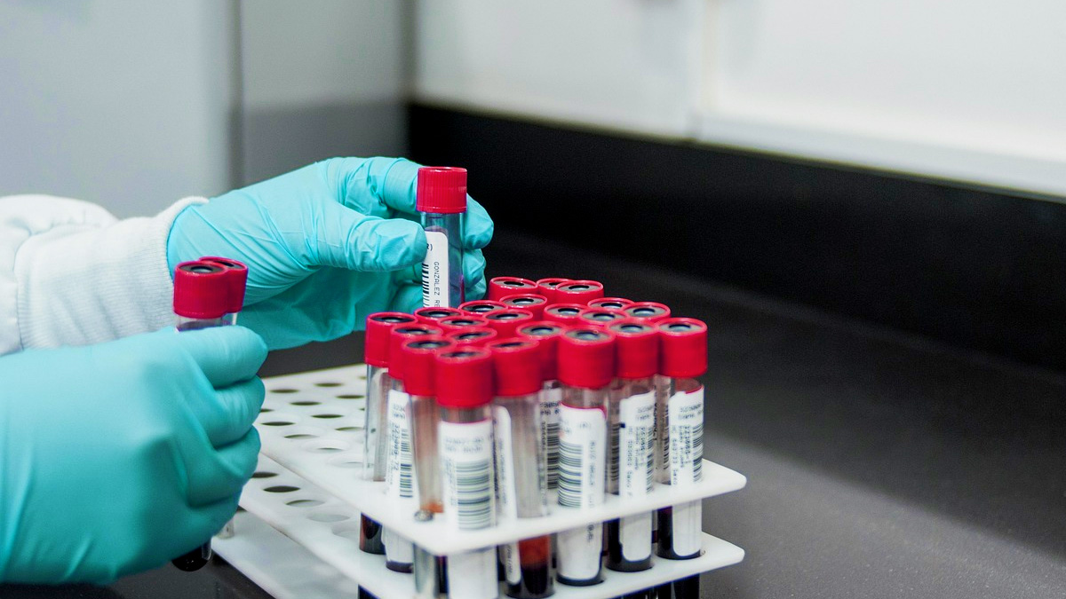 Psychopharmacology Retracts MDMA Therapy Studies Amid Ethical Concerns